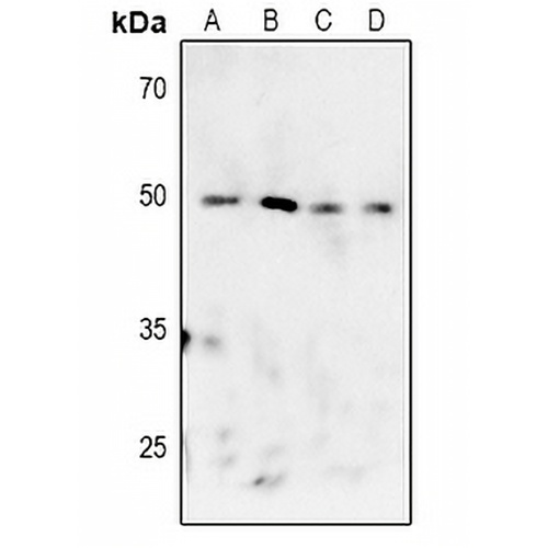 MK2 (Phospho-T222) Rabbit Polyclonal Antibody