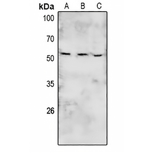 BRK (Phospho-Y447) Rabbit Polyclonal Antibody