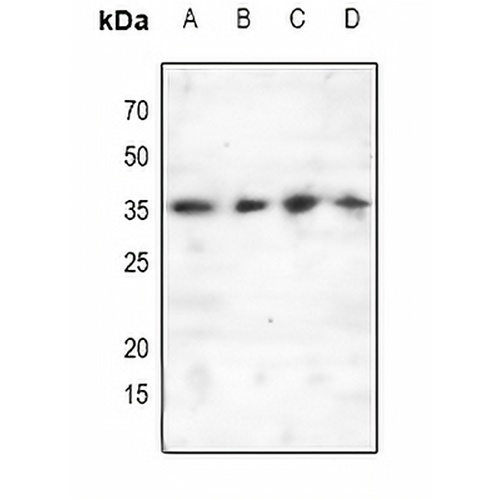 C/EBP epsilon (Phospho-T74) Rabbit Polyclonal Antibody