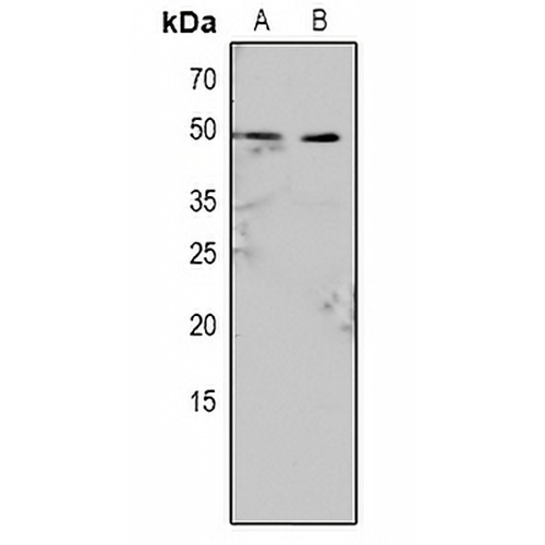 Caspase 9 (Phospho-Y153) Rabbit Polyclonal Antibody