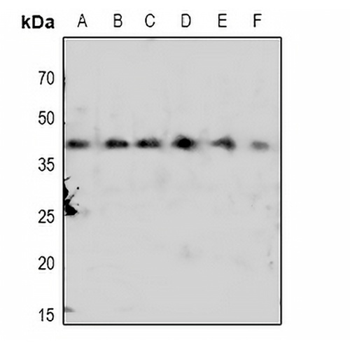 CDK7 (Phospho-T170) Rabbit Polyclonal Antibody