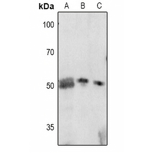 p57 Kip2 (Phospho-T310) Rabbit Polyclonal Antibody