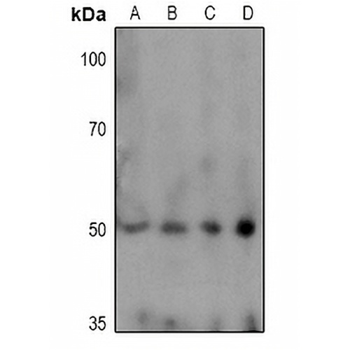 TPH1 (Phospho-S58) Rabbit Polyclonal Antibody