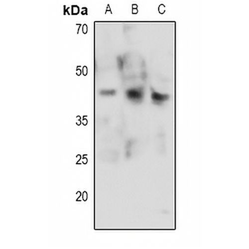 CDK9 (Phospho-T186) Rabbit Polyclonal Antibody