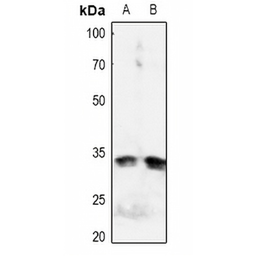 IGFBP3 (Phospho-S183) Rabbit Polyclonal Antibody