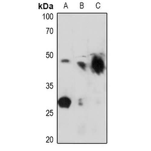 Kir6.2 (Phospho-T224) Rabbit Polyclonal Antibody