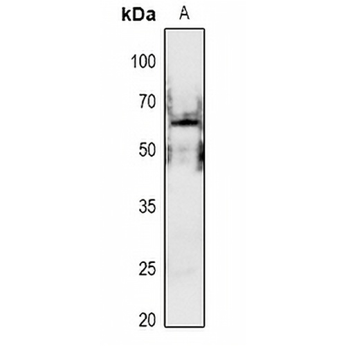 PAK1 (Phospho-S199) Rabbit Polyclonal Antibody