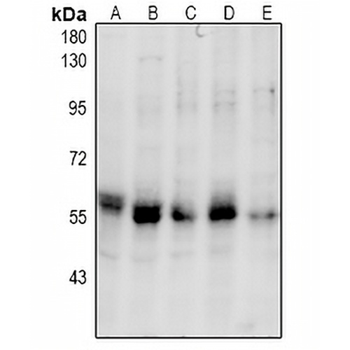 PINK1 (Phospho-S228) Rabbit Polyclonal Antibody