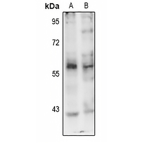 PINK1 (Phospho-S402) Rabbit Polyclonal Antibody