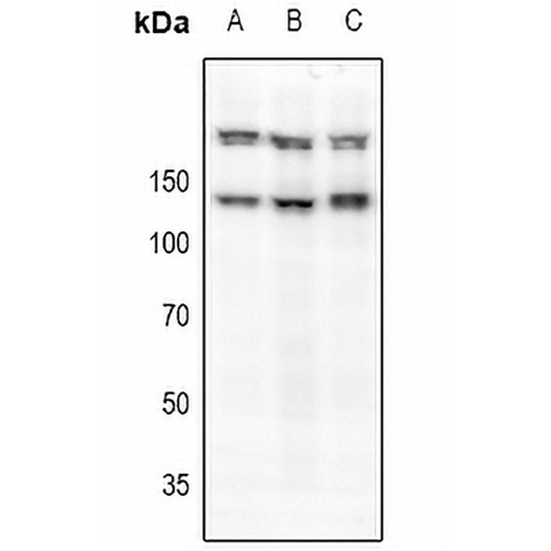 c-Met (Phospho-S985) Rabbit Polyclonal Antibody