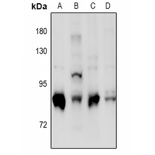 PKC delta (Phospho-S664) Rabbit Polyclonal Antibody