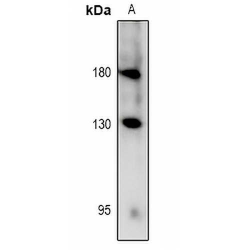 RET (Phospho-Y981) Rabbit Polyclonal Antibody