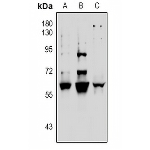 Vimentin (Phospho-S39) Rabbit Polyclonal Antibody