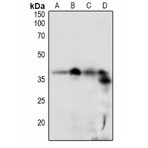DSCR1 (Phospho-S108) Rabbit Polyclonal Antibody