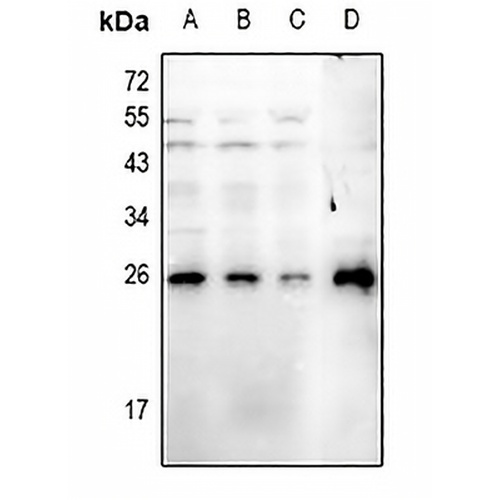 RGS19 (Phospho-S151) Rabbit Polyclonal Antibody