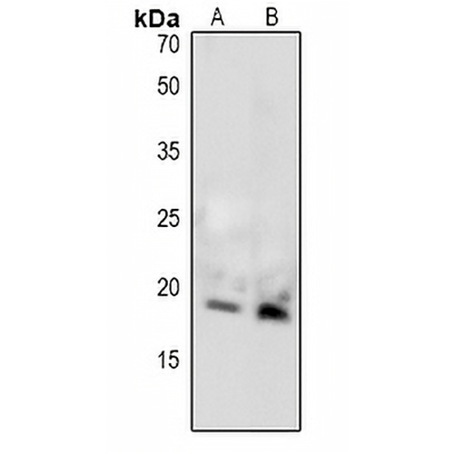MBP (Phospho-T232) Rabbit Polyclonal Antibody