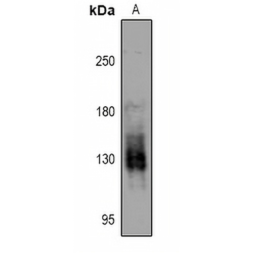 PKN1/2 (Phospho-T774/816) Rabbit Polyclonal Antibody