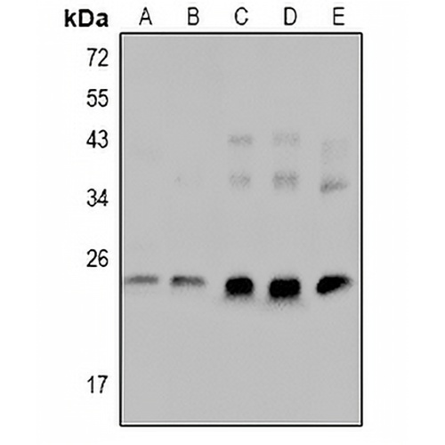 cTnI (Phospho-S23/S24) Rabbit Polyclonal Antibody