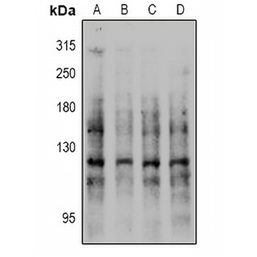 E Cadherin (Phospho-S844) Rabbit Polyclonal Antibody
