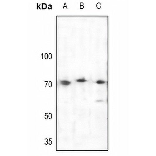 BTK Rabbit Polyclonal Antibody