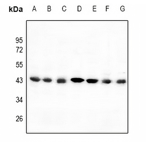 C/EBP alpha Rabbit Polyclonal Antibody