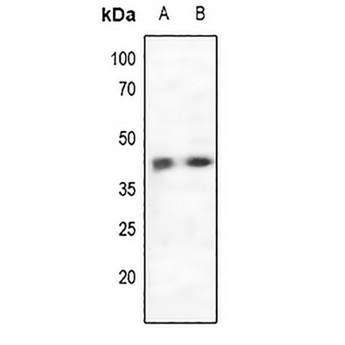 CCR5 Rabbit Polyclonal Antibody