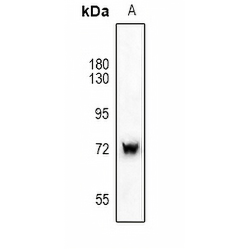 SYK Rabbit Polyclonal Antibody