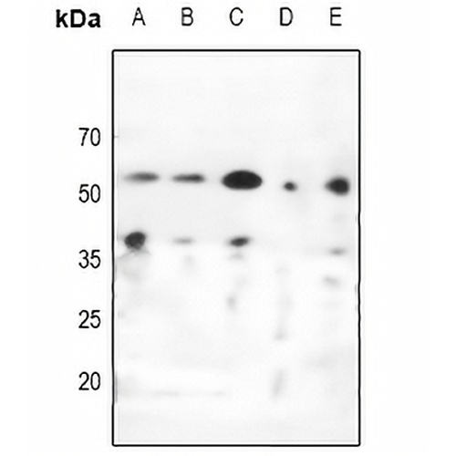 CHK1 Rabbit Polyclonal Antibody