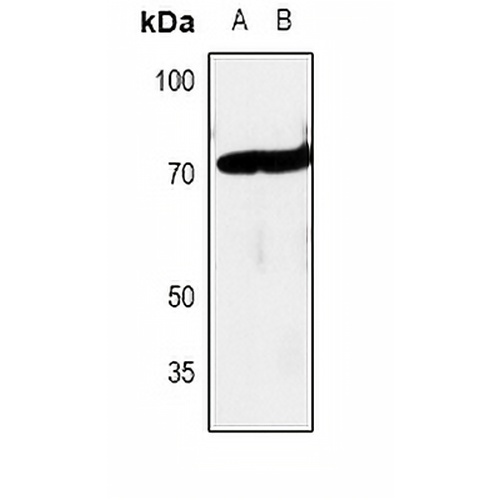 c-RAF Rabbit Polyclonal Antibody