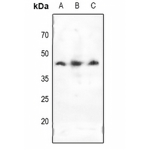 Doublecortin Rabbit Polyclonal Antibody