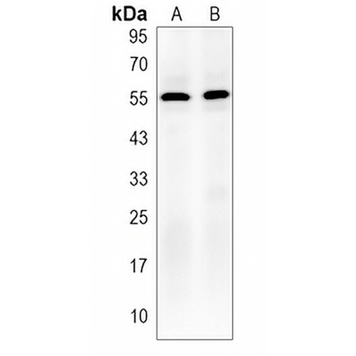 DAP Kinase 2 Rabbit Polyclonal Antibody