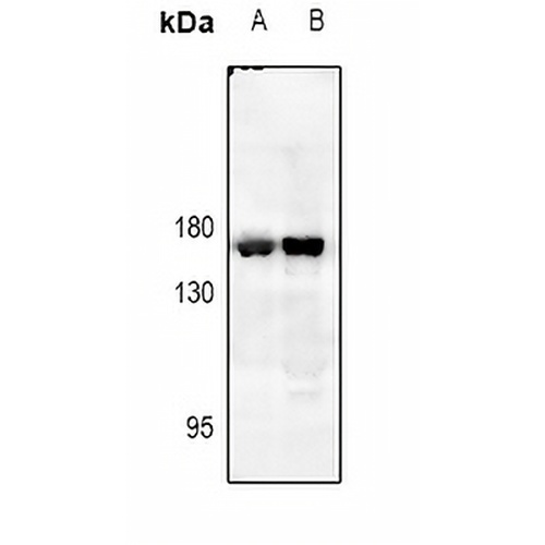 EGFR Rabbit Polyclonal Antibody