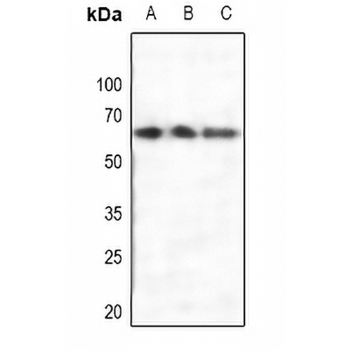 Estrogen Receptor alpha Rabbit Polyclonal Antibody