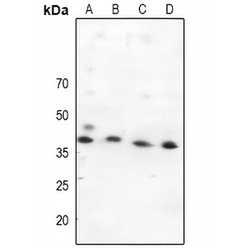 MKK4 Rabbit Polyclonal Antibody