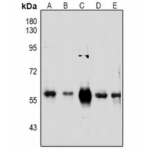 PINK1 Rabbit Polyclonal Antibody