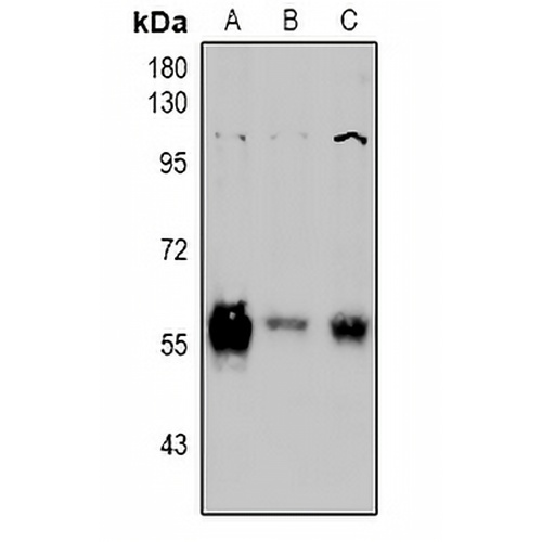PINK1 Rabbit Polyclonal Antibody