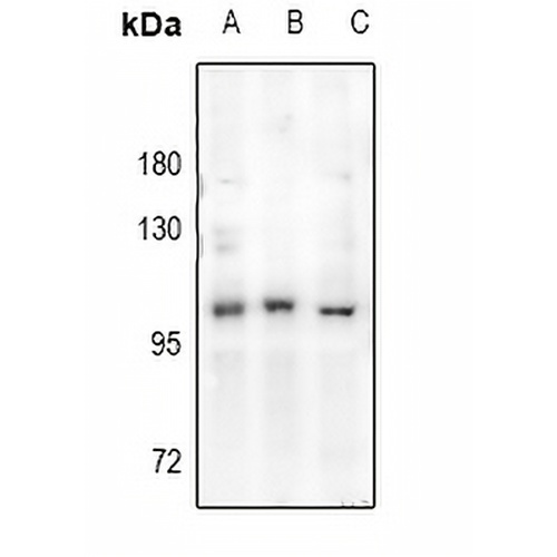 Androgen Receptor Rabbit Polyclonal Antibody