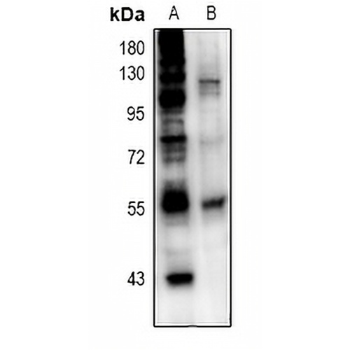 ETS1 Rabbit Polyclonal Antibody