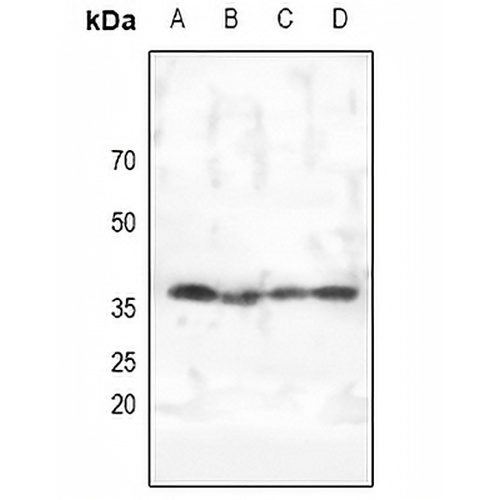 AMPK gamma 1/2/3 Rabbit Polyclonal Antibody