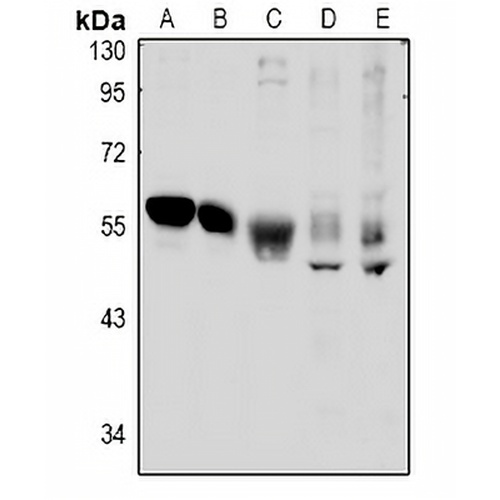 TSG101 Rabbit Polyclonal Antibody