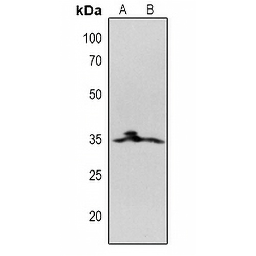CD20 Rabbit Polyclonal Antibody
