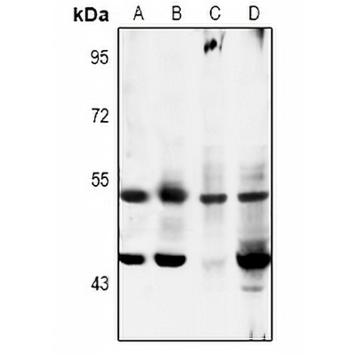 MKK5 (Phospho-S311) Rabbit Polyclonal Antibody