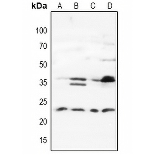 MAD2L1BP Rabbit Polyclonal Antibody