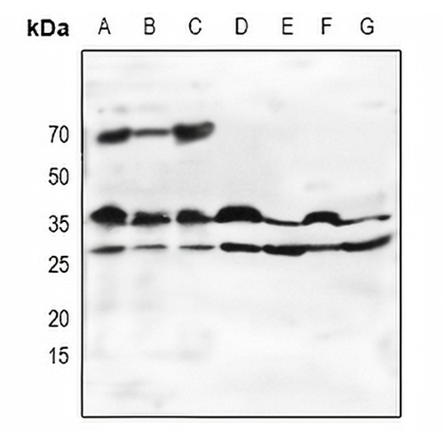 Oligo2 Rabbit Polyclonal Antibody