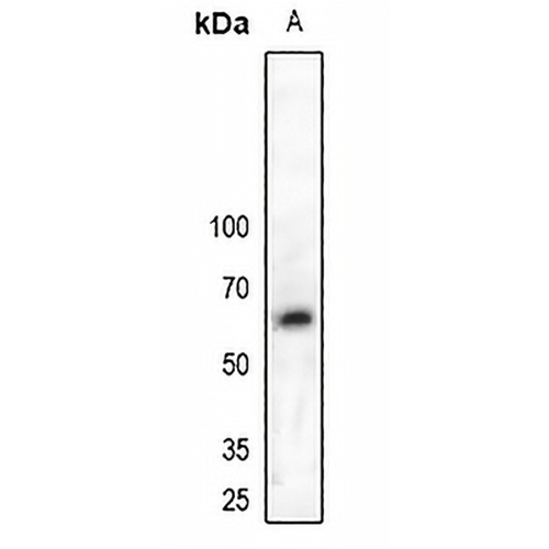 MPP6 Rabbit Polyclonal Antibody