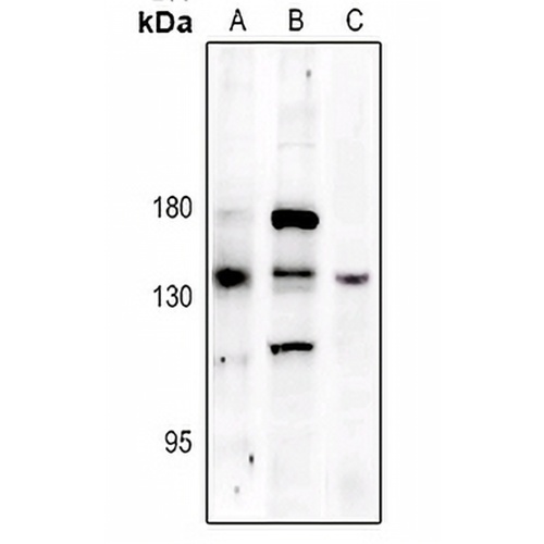 PERK (Phospho-T982) Rabbit Polyclonal Antibody
