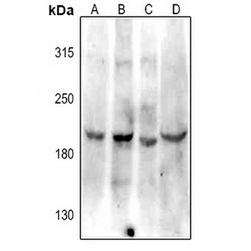 VEGFR2 Rabbit Polyclonal Antibody