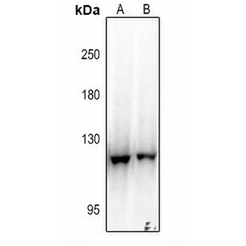 EPHB3 Rabbit Polyclonal Antibody