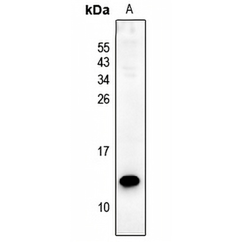 PS2 Rabbit Polyclonal Antibody