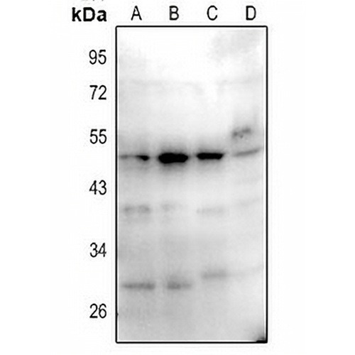 CD1a/b Rabbit Polyclonal Antibody